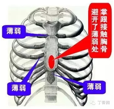 有时按着按着就可能不自觉地按到了胸骨外的部位,如果不慎压在了薄弱